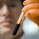 Nobelprijs voor uitvinders nieuwe microscooptechnieken