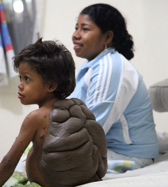 L Enfant Tortue A Retrouve Une Forme Humaine Sante Bien Etre 7sur7 Be
