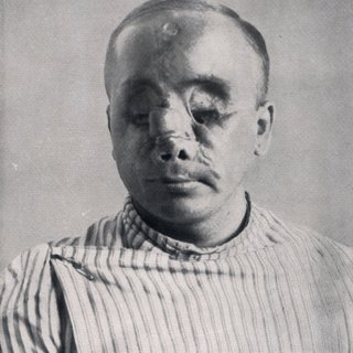 Images of mutilated soldiers as an indictment of war: Ernst Friedrich's War Against War feels unfortunately relevant again