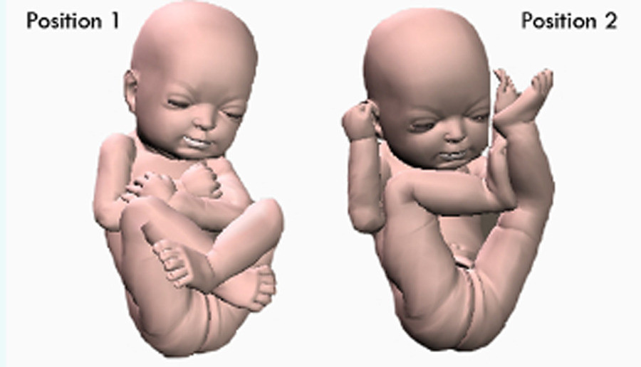 Pour "tenir votre bébé dans votre bras avant sa naissance" Foto