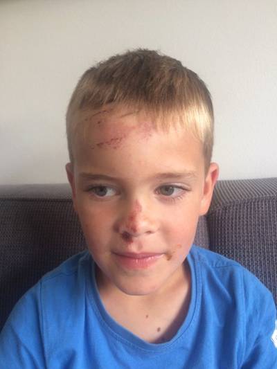 Tieners mishandelen 7-jarig jongetje