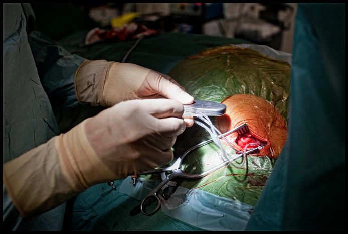De ICD is een implanteerbare inwendige defibrillator die een schok afgeeft bij een te hoog of te laag hartritme.