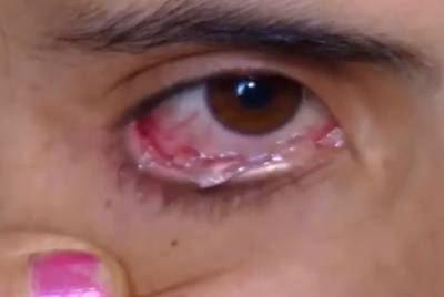 Vrouw die kristallen huilt in plaats van echte tranen ontmaskerd als oplichter: ‘Het is gewoon glas’