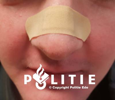 Politie zoekt neusbijter in Ede: ‘opvallende en laffe mishandeling’