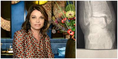 Goedele Liekens loopt zware breuk op op vakantie: ‘Voorlopig zit ik hier vast’