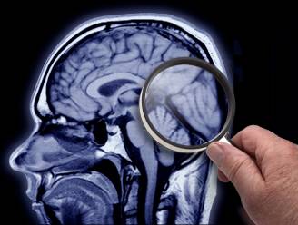 Neurologische aandoeningen zijn wereldwijd belangrijkste oorzaak van ziekte: “Meer dan 1 op de 3 getroffen blijkt uit onderzoek” 