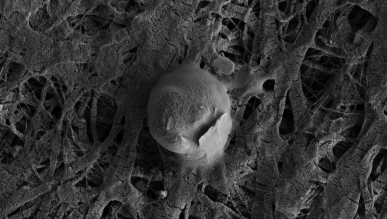 Een micro-organisme uit Lake Whillans, zoals te zien door een microscoop. Beeld Trista Vick-Majors