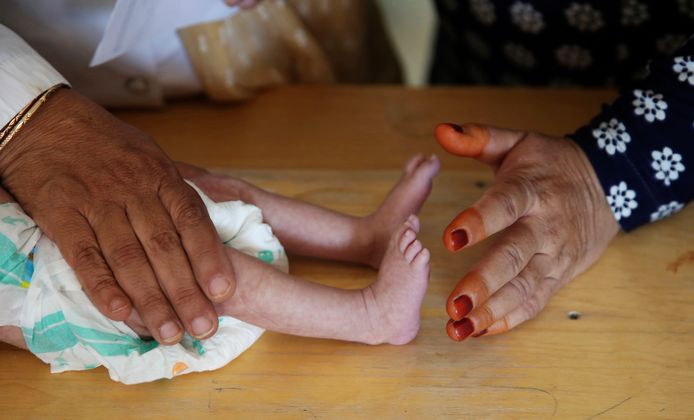 Een verpleegster meet de voeten van een ondervoede baby in een ziekenhuis in Afghanistan. Beeld uit 2019.