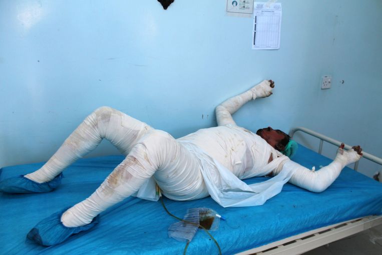 Een Jemeniet die gewond is geraakt wordt behandeld in een ziekenhuis in de havenstad Hodeidah. Beeld afp