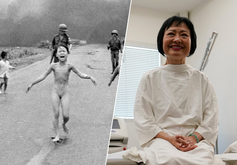 Phan Thi Kim Phuc, bekend als 'het napalmmeisje', heeft meer dan 50 jaar nadat de iconische foto (links) van haar werd genomen haar laatste huidbehandeling ondergaan.