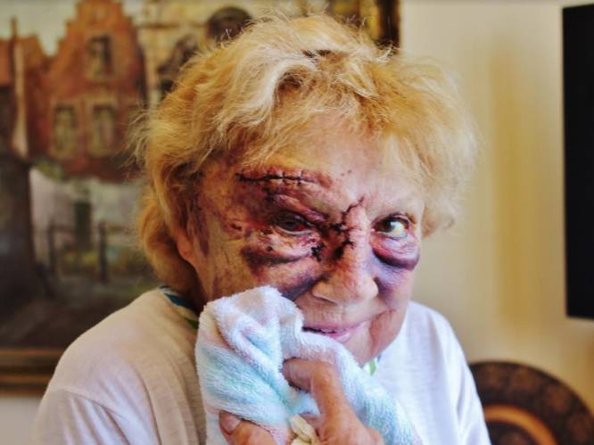 Jacqueline (78) met baseballknuppel in elkaar geslagen, dader spoorloos: "Hij liet me voor dood achter"