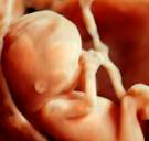 Onderzoek UHasselt bewijst: ‘Luchtvervuiling dringt door tot in de baarmoeder’