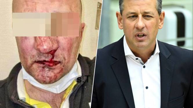 Buschauffeurs leggen werk neer na zware agressie in Genk: “Laat hen bodycams dragen als afschrikmiddel”