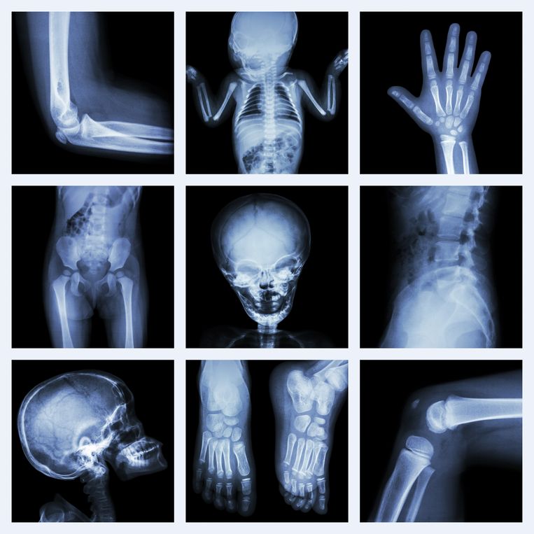 null Beeld Getty Images