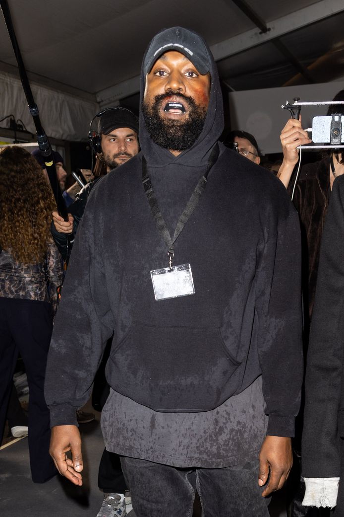 Kanye 'Ye' West met de kneuzingen op zijn gezicht