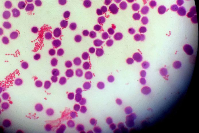 Een Gram-negatieve bacteriële bloedbaaninfectie gezien door een microscoop.