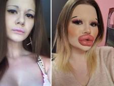 Cette influenceuse bulgare veut se transformer en poupée Bratz: après une trentaine d'injections aux lèvres, elle s’attaque à ses pommettes