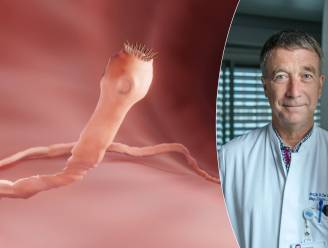 Heb je last van vage buikpijn en krampen? Misschien is het wel een lintworm: “Ze kunnen tot 10 meter lang worden”