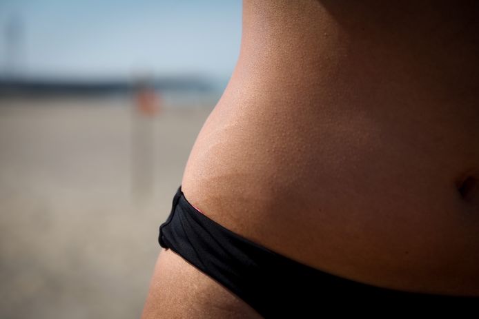 I: "Stretch marks make me feel insecure."