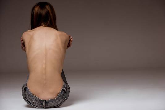 Een kwart van de jonge vrouwen, want daar gaat het meestal om, geneest niet van anorexia.