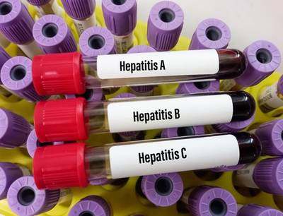 Hepatitisuitbraak bij kinderen niet gelinkt aan Covid-19, wellicht wel aan een ander virus
