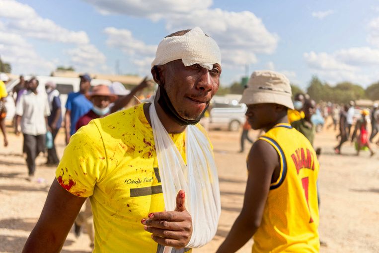 Een gewonde aanhanger van de oppositiepartij CCC van Nelson Chamisa. Leden van de jeugdafdeling van de regerende Zanu-PF van president Emerson Mnangagwa vielen een bijeenkomst van de CCC aan.
 Beeld AFP