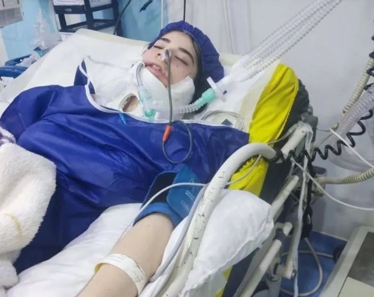 Agenten hadden de 17-jarige Arnica langs achteren geslagen met een wapenstok, waardoor zij levensgevaarlijke verwondingen opliep. Beeld iranhrs/twitter