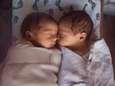 Katja aurait dû naître jumelle: un expert explique ce qu’est le “syndrome du jumeau perdu”