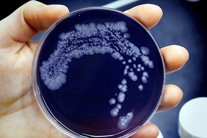 De legionella-bacterie.