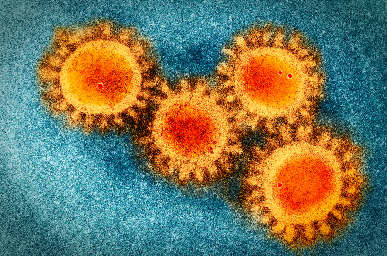 Colored visualisation of electron microscopy photo of the coronavirus COVID-19, foto: Getty Images