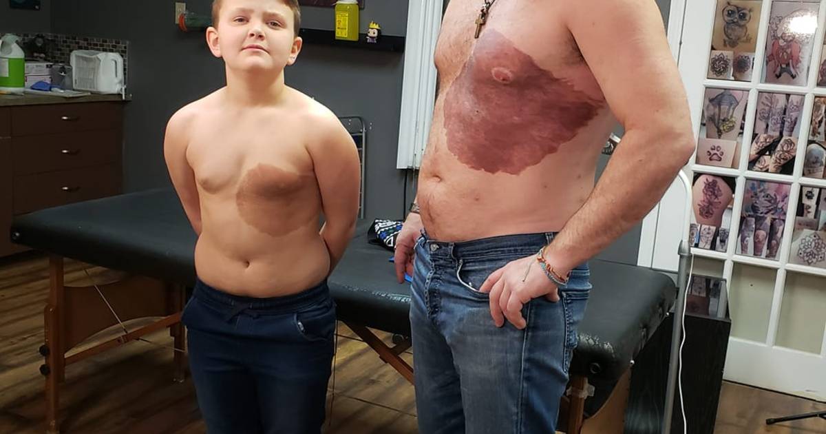 Il Se Tatoue La Meme Tache De Naissance Que Son Fils Pour Une Jolie Raison Famille 7sur7 Be