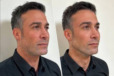 Fabrizio Tzinaridis onherkenbaar na cosmetische ingreep en scheerbeurt: “Ik liet mijn kaaklijn verstrakken”