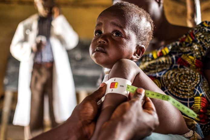 Gezondheidsmedewerkers meten de omvang van een kinderarmpje in het kader van een programma voor ondervoede kinderen in de Democratische Republiek Congo.