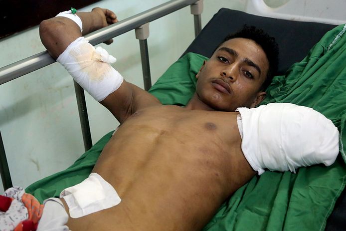Deze jongeman raakte gewond bij de bombardementen.