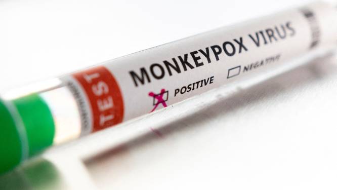 Farmabedrijf Roche ontwikkelt PCR-tests die apenpokkenvirus opsporen
