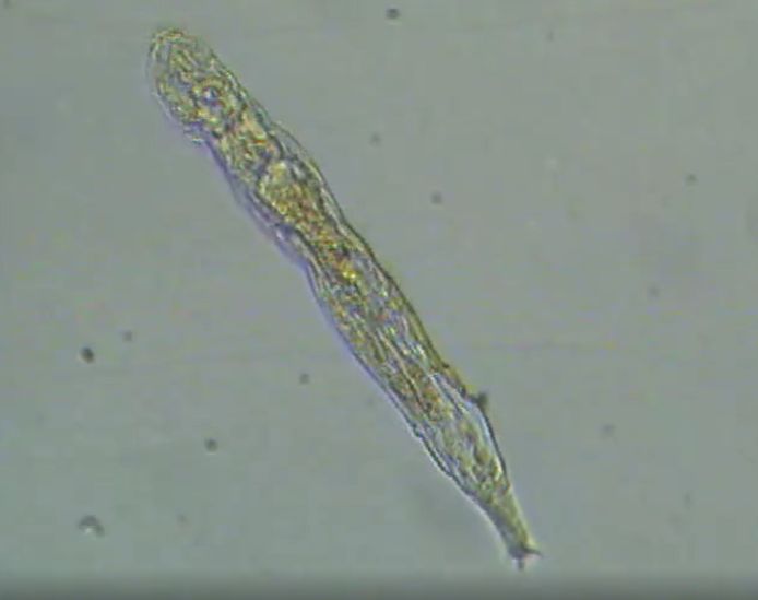 Cette espèce animale microscopique, le bdelloïde, a survécu dans le permafrost sibérien pendant 24.000 ans