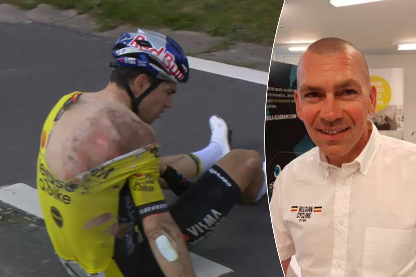 Hoe gevaarlijk zijn gebroken ribben zoals bij Wout Van Aert? Sportarts geeft uitleg over herstel
