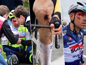 Breuken, gapende wonden en hersenschuddingen: het ellenlange medische bulletin na zéér incidentrijke Ronde