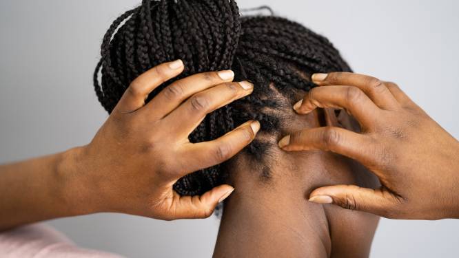 Verzorg jij je hoofdhuid? ‘Scalpcare’ is trending op het internet. “Vaak je haar wassen: doe maar niet” 
