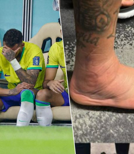 Dat ziet er niet goed uit voor Neymar: Brazili­aanse superster deelt foto van gezwollen voet 