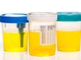 Une application qui analyse l'urine