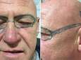 Man wordt wakker na vrijgezellenavond: Ray-Ban op gezicht getatoeëerd