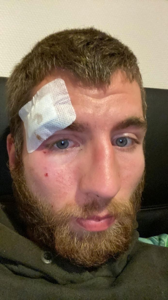 Slachtoffer Xander (25) liep een gapende hoofdwonde op door de brutale aanval.