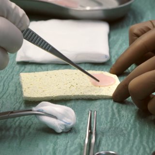 Medicii repară pentru prima dată un inimă deteriorată cu un plasture viu, creat din celule stem   