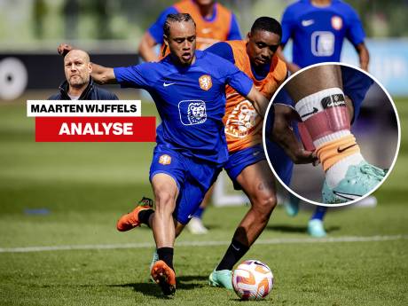 Alles is veilig bij Oranje, behalve de dure benen