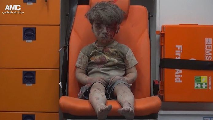 Omran werd het gezicht van de slachting in Syrië.