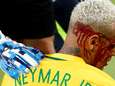 En sang, Neymar quitte le terrain après un coup de coude