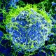 Mooi, maar dodelijk: het ebola-virus, 20 duizend maal vergroot door een elektronenmicroscoop