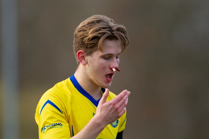 Hatto Heim-spits Jesse Winkelaar is gehavend na een van de talloze harde duels die werden uitgevochten gedurende Hatto Heim - VSCO'61.