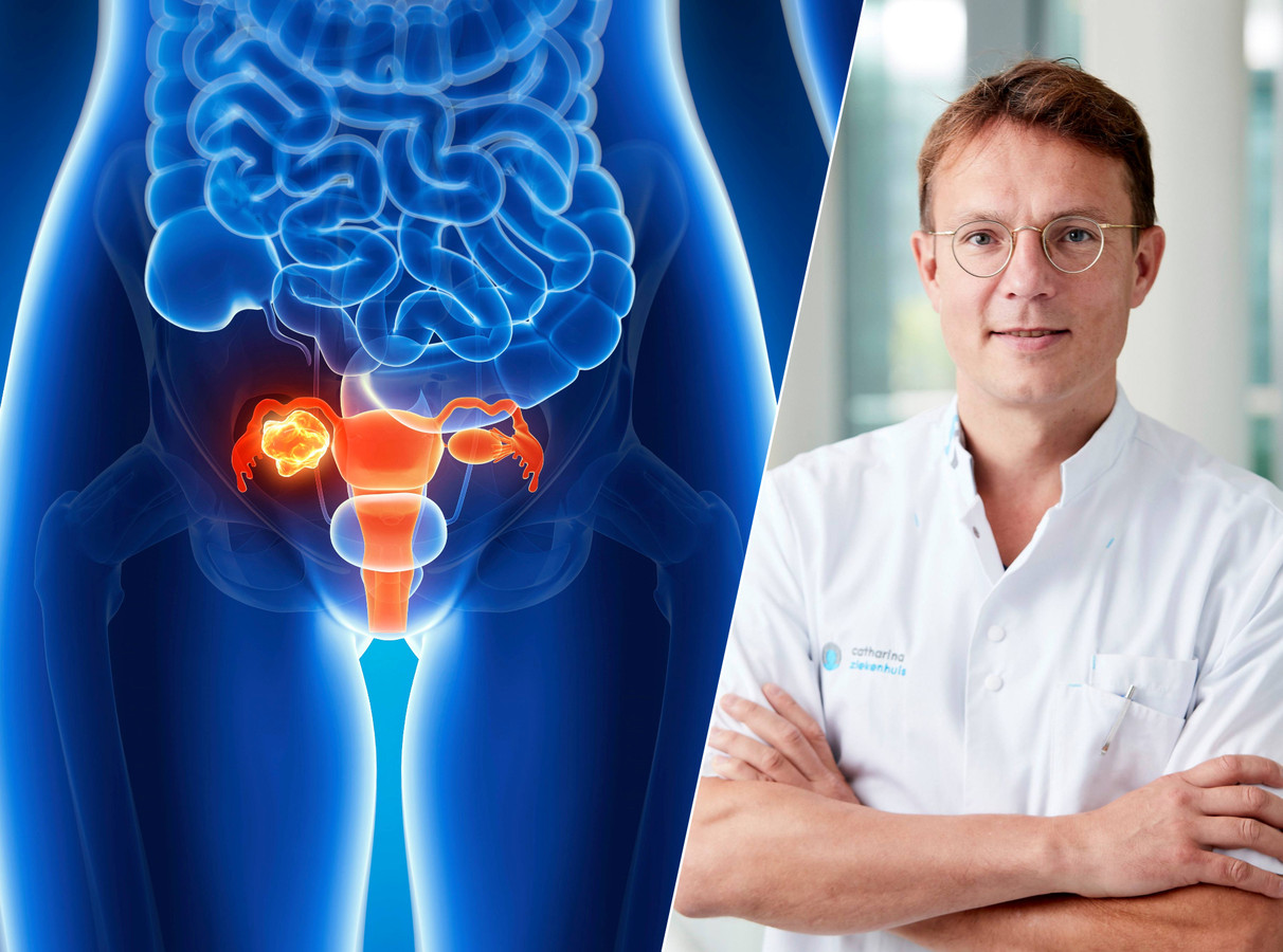 Dit moet je volgens oncoloog weten over eierstokkanker ‘Niet voor